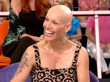 Dora Gálvez, con alopecia autoinmune, reivindica la existencia de mujeres calvas en la sociedad: "Yo me odiaba" Dora Gálvez, con alopecia autoinmune, reivindica la existencia de mujeres calvas en la sociedad: "Yo me odiaba"