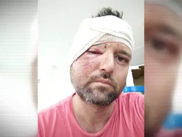 Daniel casi muere por un caballo que se lanzó a su coche mientras conducía: "Los médicos hablan de un milagro" Daniel casi muere por un caballo que se lanzó a su coche mientras conducía: "Los médicos hablan de un milagro"