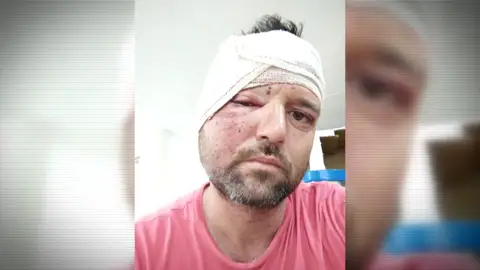 Daniel casi muere por un caballo que se lanzó a su coche mientras conducía: "Los médicos hablan de un milagro" Daniel casi muere por un caballo que se lanzó a su coche mientras conducía: "Los médicos hablan de un milagro"