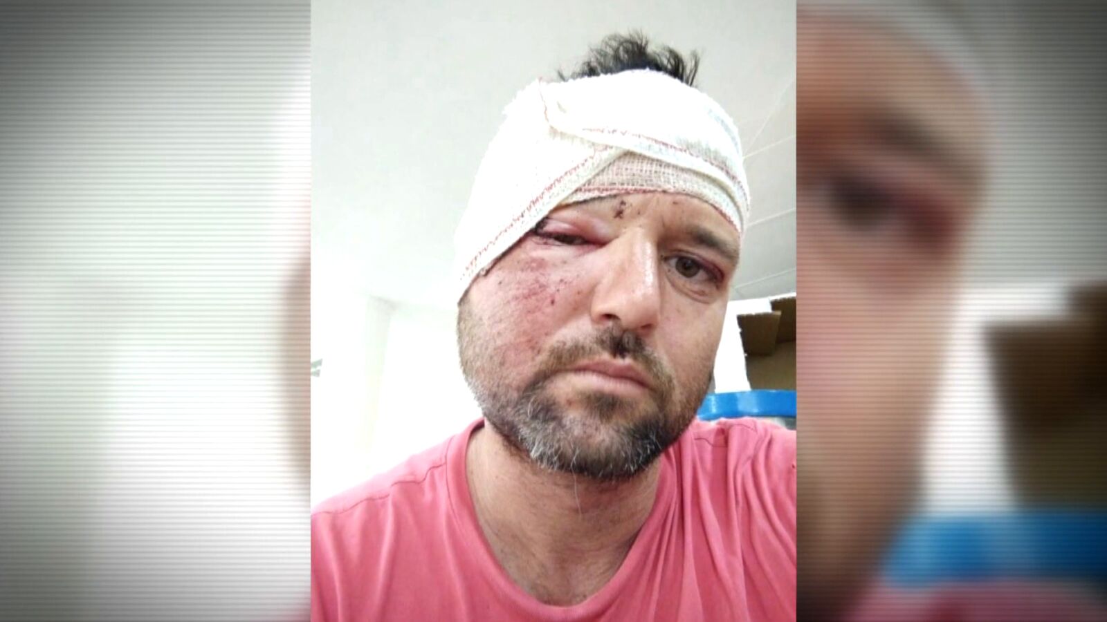 Daniel casi muere por un caballo que se lanzó a su coche mientras conducía: 