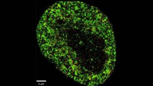 Imagen microsc&oacute;pica de una c&eacute;lula cancerosa 