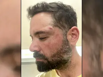 Una orquesta es brutalmente apalizada por un grupo de jóvenes en El Barco de Ávila Una orquesta es brutalmente apalizada por un grupo de jóvenes en El Barco de Ávila