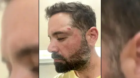 Una orquesta es brutalmente apalizada por un grupo de jóvenes en El Barco de Ávila Una orquesta es brutalmente apalizada por un grupo de jóvenes en El Barco de Ávila