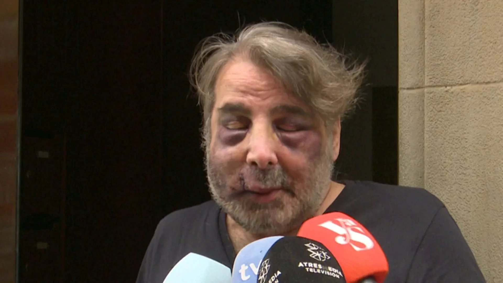 Paliza a un hombre en Ferrol