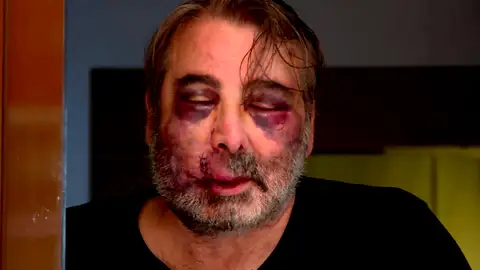 Le destrozan la cara por quejarse del ruido Le destrozan la cara por quejarse del ruido