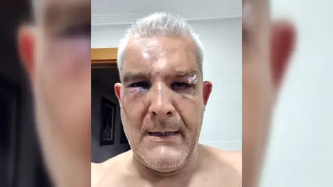 Pepe, agredido por advertir a un joven que recoja los excrementos de su perro Pepe, agredido por advertir a un joven que recoja los excrementos de su perro