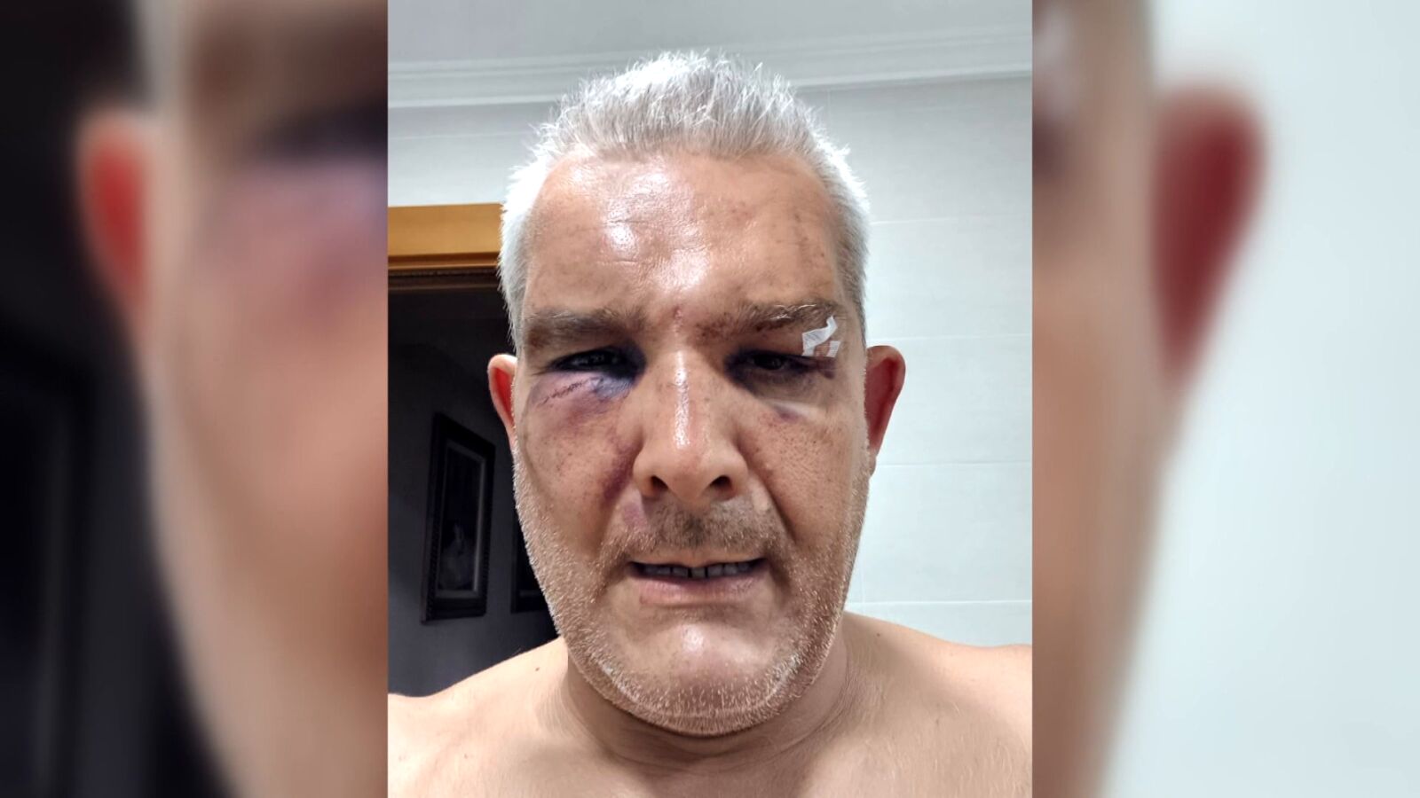 Pepe, agredido por advertir a un joven que recoja los excrementos de su perro: 