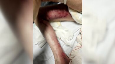 Una mujer de 71 años, abrasada con agua caliente en la residencia: 