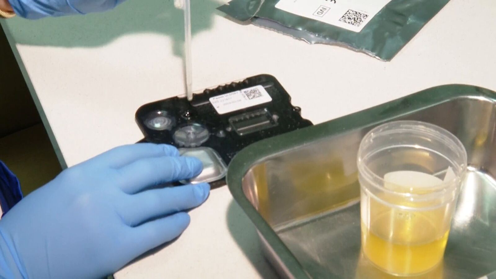Una nueva técnica selecciona en 45 minutos el antibiótico más adecuado para infecciones urinarias 