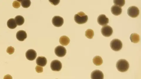 El CSIC descubre un mecanismo que acelera la evolución de bacterias resistentes a los antibióticos El CSIC descubre un mecanismo que acelera la evolución de bacterias resistentes a los antibióticos