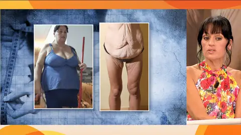 Vanesa, incapaz de reconocerse tras perder casi 60 kilos: "El problema es cuando me quito la ropa" Vanesa, incapaz de reconocerse tras perder casi 60 kilos: "El problema es cuando me quito la ropa"