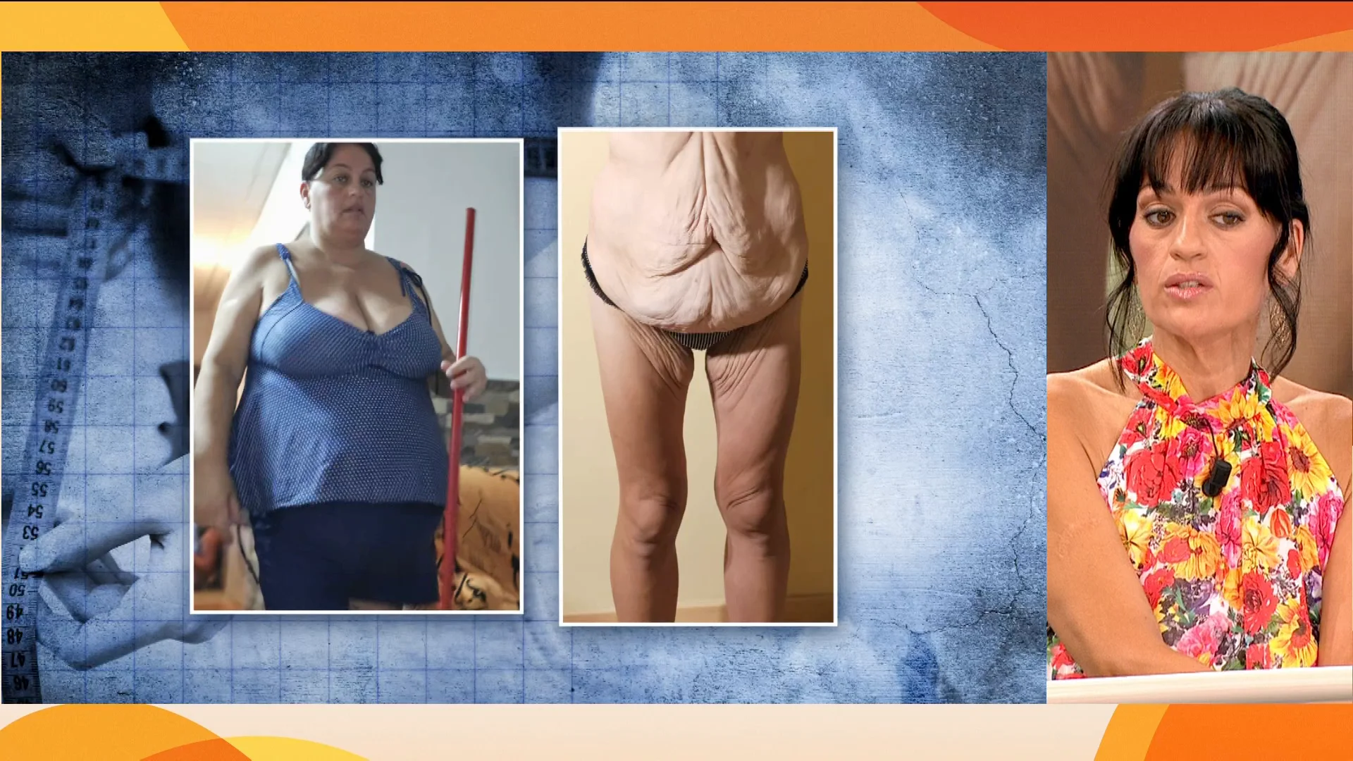 Vanesa, incapaz de reconocerse tras perder casi 60 kilos: "El problema es cuando me quito la ropa" Vanesa, incapaz de reconocerse tras perder casi 60 kilos: "El problema es cuando me quito la ropa"