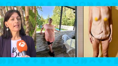 Vanessa García, la jerezana que pide ayuda para reconstruir su cuerpo tras perder 60 kilos: 