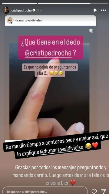 La respuesta de la Dra. Valdivielso sobre el problema en el dedo de Cristina Pedroche La respuesta de la Dra. Valdivielso sobre el problema en el dedo de Cristina Pedroche