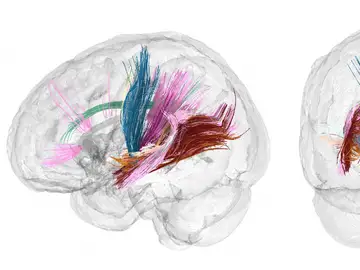 Cerebro en el embarazo Cerebro en el embarazo