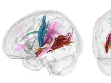 Cerebro en el embarazo Cerebro en el embarazo