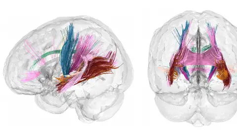 Cerebro en el embarazo Cerebro en el embarazo