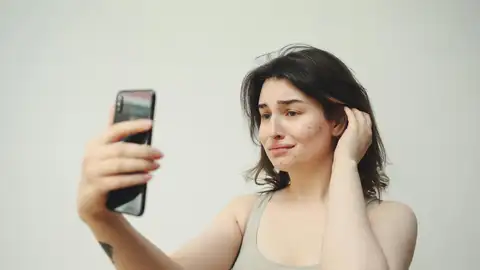 Chica con granitos en la mejilla Chica con granitos en la mejilla