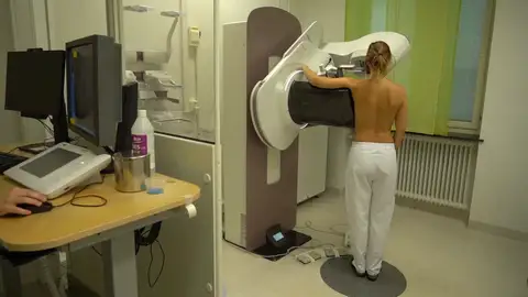 Cáncer de mama Cáncer de mama