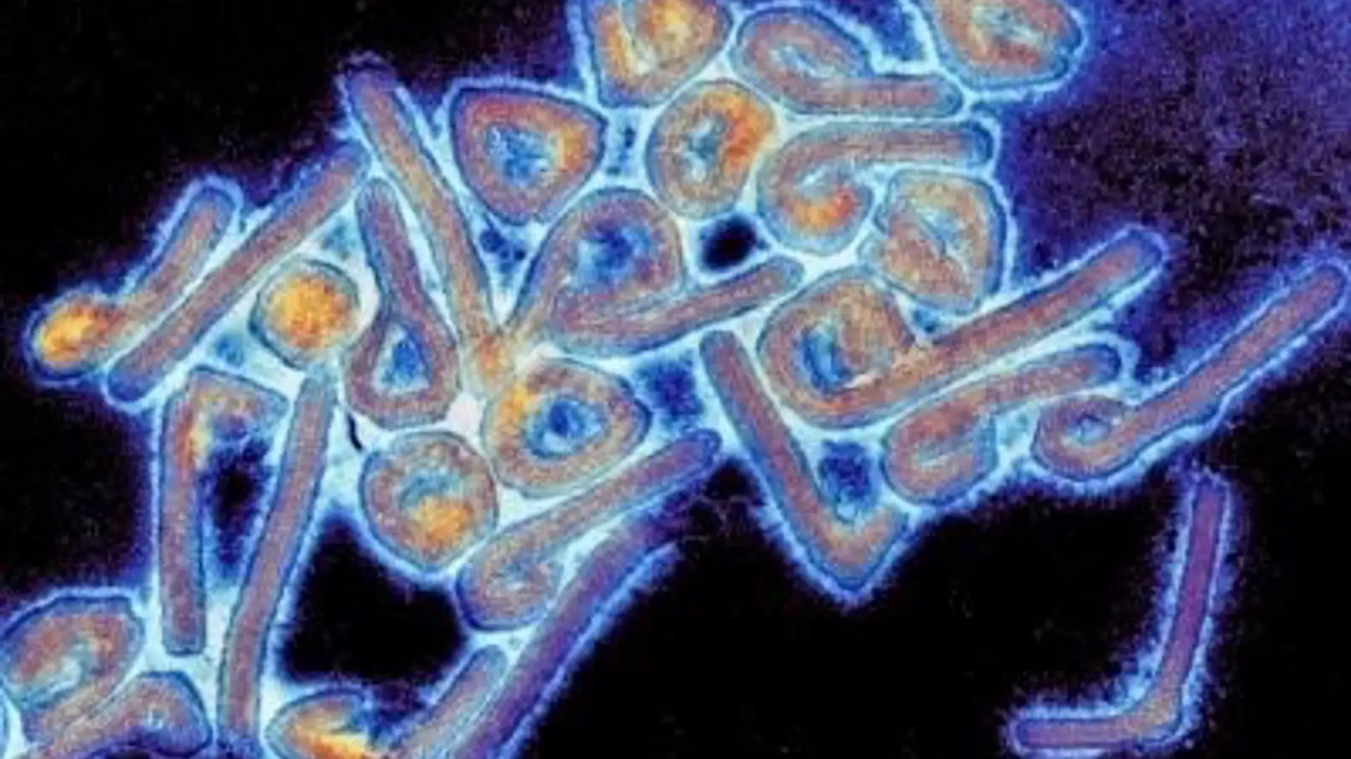 Seis muertos por un nuevo brote del virus de Marburgo en Ruanda Seis muertos por un nuevo brote del virus de Marburgo en Ruanda