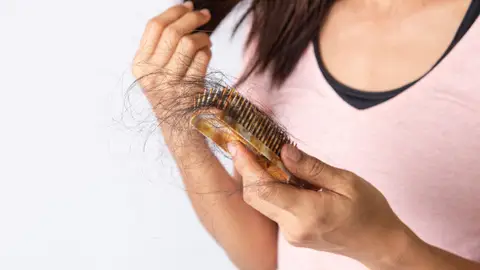 Caída del cabello en otoño Caída del cabello en otoño
