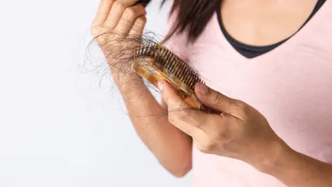 Alopecia y caída del cabello Alopecia y caída del cabello