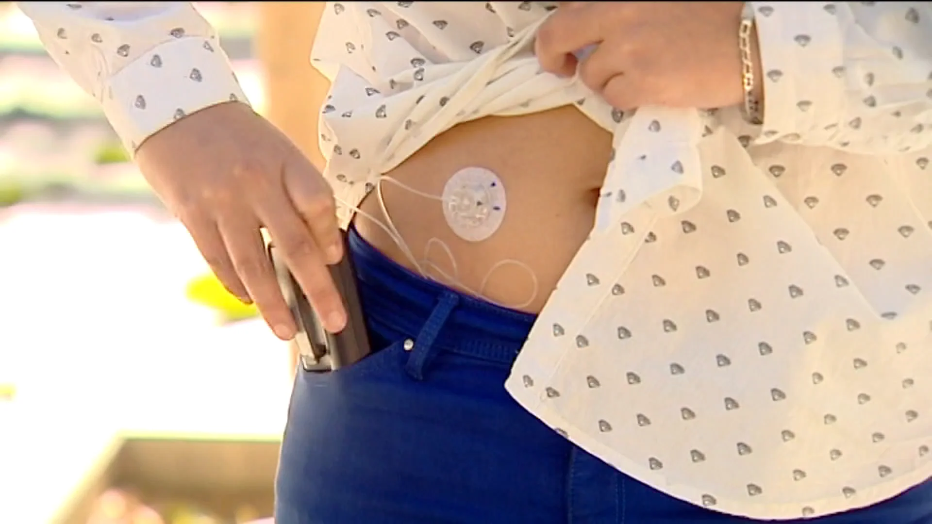 Una mujer con diabetes Una mujer con diabetes