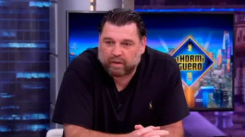 Hovik Keuchkerian desvela su mayor secreto: "Me hago quemaduras para conectar con esos momentos" Hovik Keuchkerian desvela su mayor secreto: "Me hago quemaduras para conectar con esos momentos"