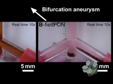 Nanorrobots guiados logran curar aneurismas cerebrales