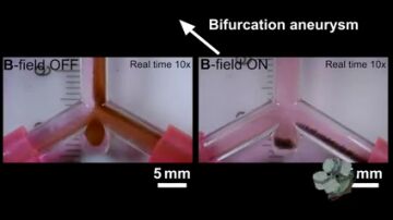 Nanorrobots guiados logran curar aneurismas cerebrales