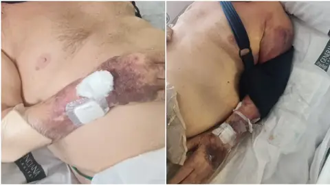 Las heridas del anciano Las heridas del anciano