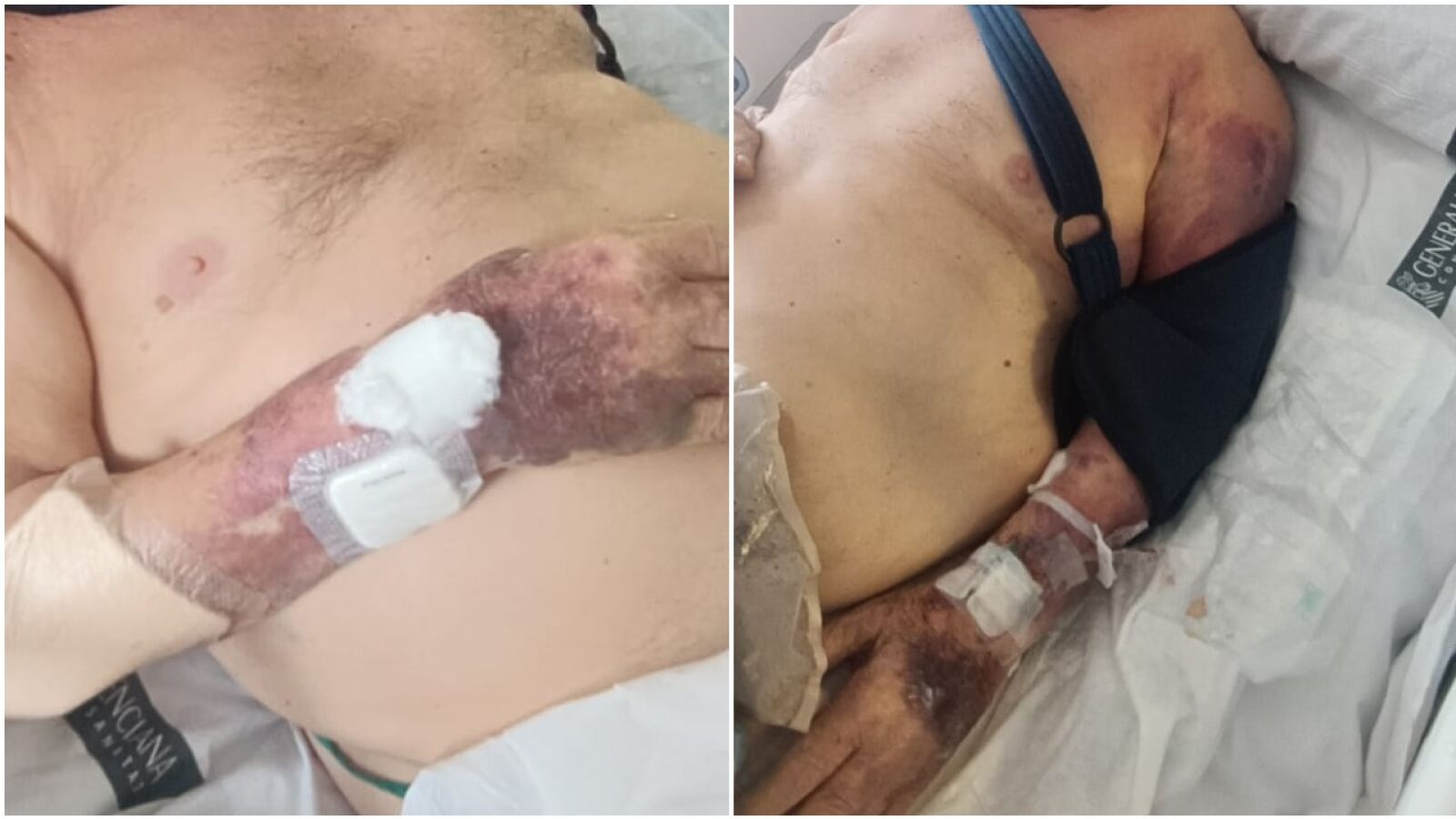Asaltado, amordazado y apaleado en su domicilio: 