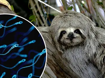 Montaje de un perezoso y espermatozoides Montaje de un perezoso y espermatozoides