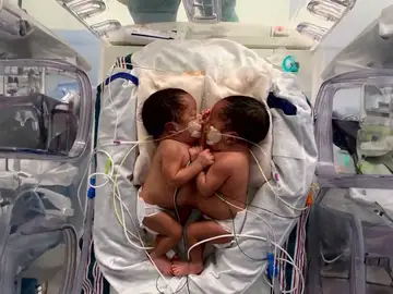 Imagen de los bebés Imagen de los bebés