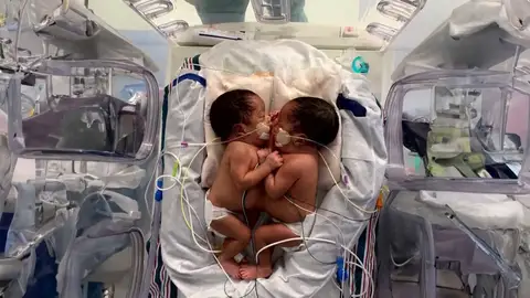 Imagen de los bebés Imagen de los bebés