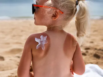 Niña en la playa con una marca solar en la espalda Niña en la playa con una marca solar en la espalda