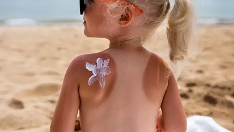 Niña en la playa con una marca solar en la espalda Niña en la playa con una marca solar en la espalda