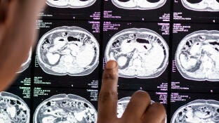 Doctor lee el resultado de la radiograf&iacute;a del cerebro