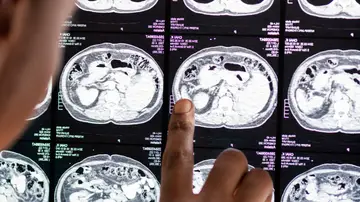 Doctor lee el resultado de la radiografía del cerebro Doctor lee el resultado de la radiografía del cerebro