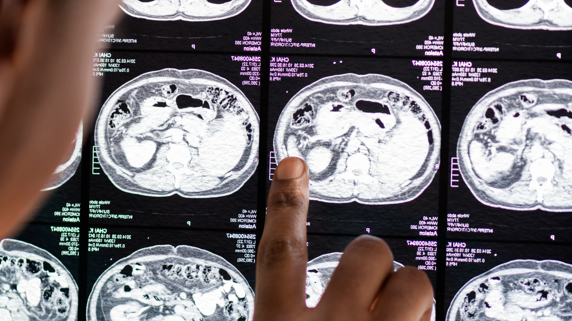 Doctor lee el resultado de la radiografía del cerebro Doctor lee el resultado de la radiografía del cerebro