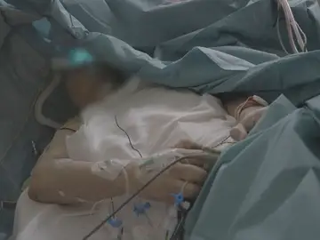 El paciente en plena operación El paciente en plena operación