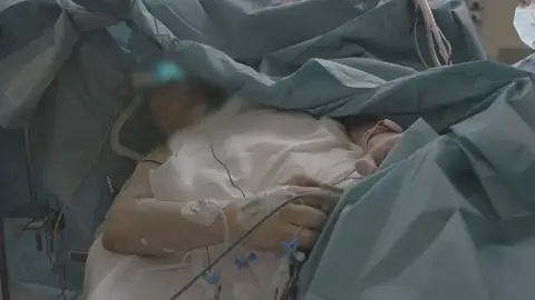 El paciente en plena operación El paciente en plena operación
