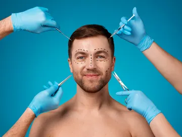 Operación estética de un hombre Operación estética de un hombre