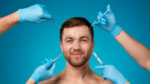 Operación estética de un hombre Operación estética de un hombre
