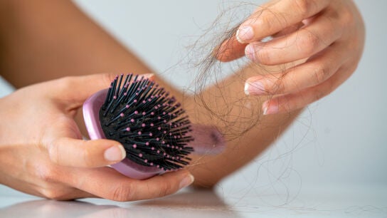 Pelo ca&iacute;do