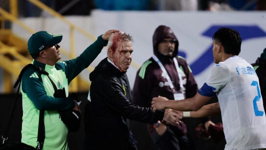 Javier Aguirre, sangrando tras la agresi&oacute;n