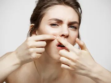 Mujer extrayéndose un poro o un filamento sebáceo de la piel Mujer extrayéndose un poro o un filamento sebáceo de la piel