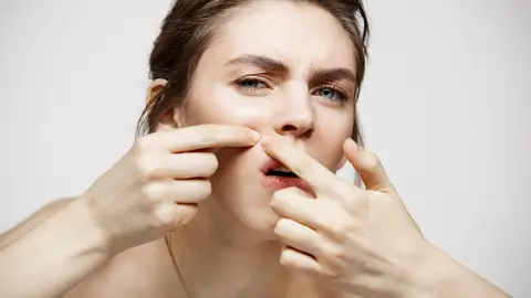 Mujer extrayéndose un poro o un filamento sebáceo de la piel Mujer extrayéndose un poro o un filamento sebáceo de la piel