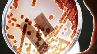 bacterias resistentes a antibióticos bacterias resistentes a antibióticos