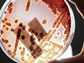 bacterias resistentes a antibióticos